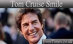 A Closer Look at Hollywood's Smile Struggles