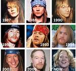 Axl Rose Now: the Evolution of a Rock Legend