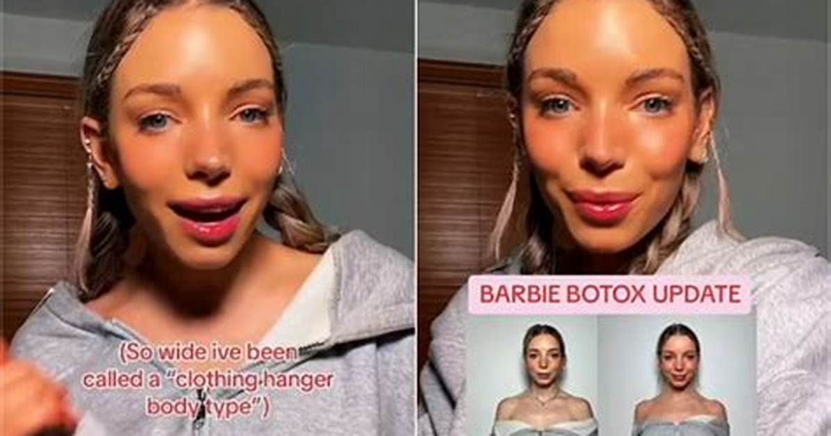 Barbie Botox: the Beauty Trend Taking the World by Storm