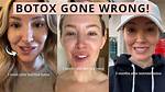 Botox Went Wrong: Understanding the Risks and Consequences