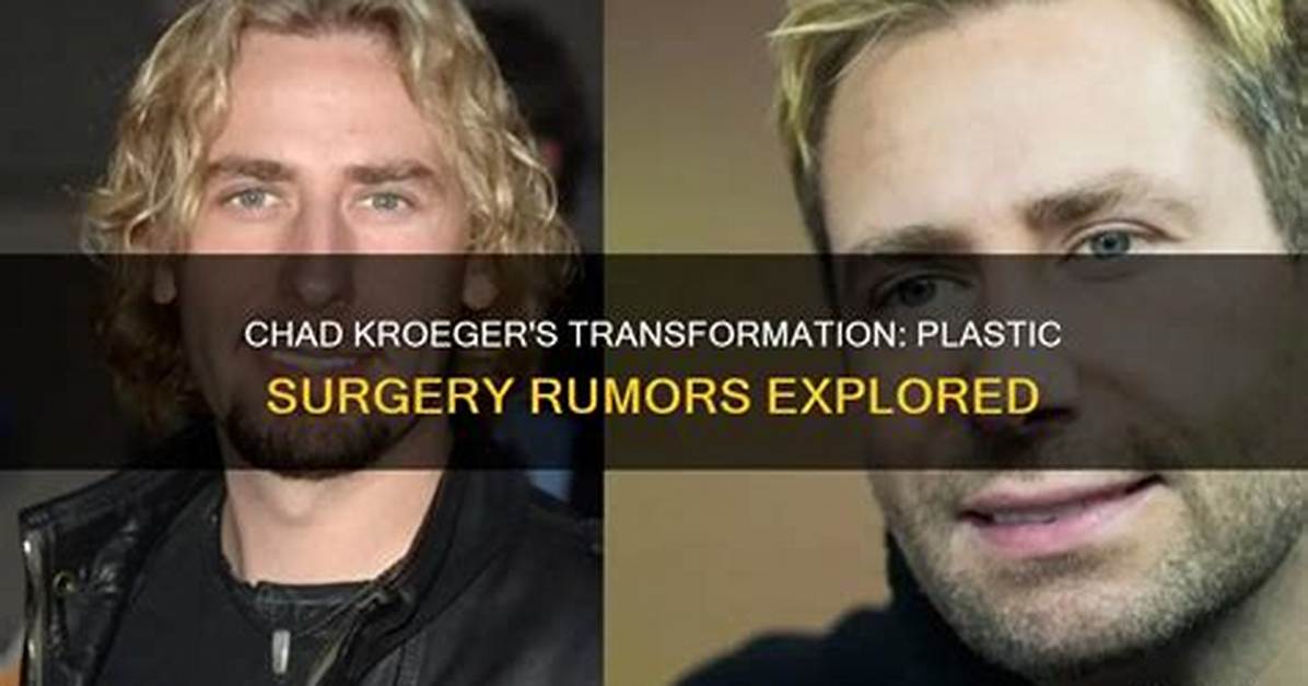 Chad Kroeger: the Transformation and Speculations of Plastic Surgery