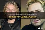 Chad Kroeger: the Transformation and Speculations of Plastic Surgery