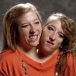 Conjoined Twins Abby and Brittany Hensel Now Work as Teachers