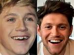 Did He Wear Braces Then and Now