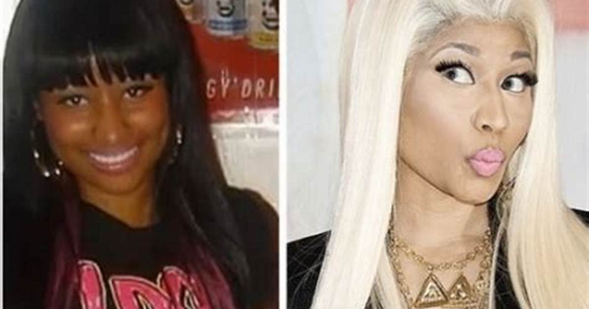 Did Nicki Minaj Bleach Her Skin?