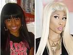 Did Nicki Minaj Bleach Her Skin?