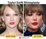 Did She Get Nose Job?