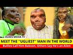 Discovering the 'Ugliest Man in the World'