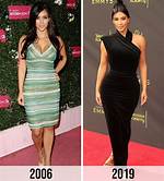 Does Kim Kardashian Have Butt Implants? the Truth Behind the Rumors