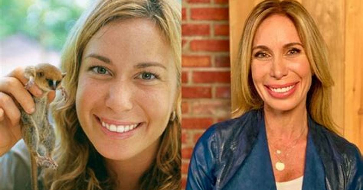 Dr. Mireya Mayor Lips Surgery: Transforming Smiles with Expertise