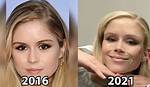 Erin Moriarty's Plastic Surgery Journey Unveiled