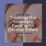 Exploring the Connection Between Ozempic and Lupus: What You Need to Know