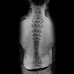 Exploring the Enigma of Spinal Cord Tattoos