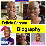 Felicia of Big Brother Opens up About Hair Loss Journey