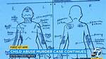 Gabriel Fernandez Autopsy Report: How Did He Suffer?