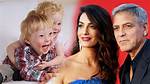 George Clooney Twins Down Syndrome: an Insightful Exploration