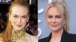 Has Nicole Kidman: Plastic Surgery Truth Revealed?
