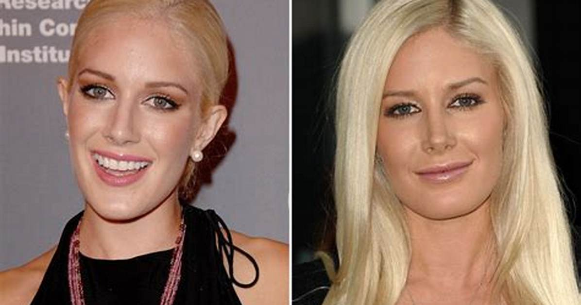 Heidi Montag Before and After Surgery: Navigating the Reality Tv Stars Transformation