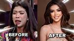 Herlene Budol Before and After Pictures Did She Get a Nose Job? Details About Her Plastic Surgery