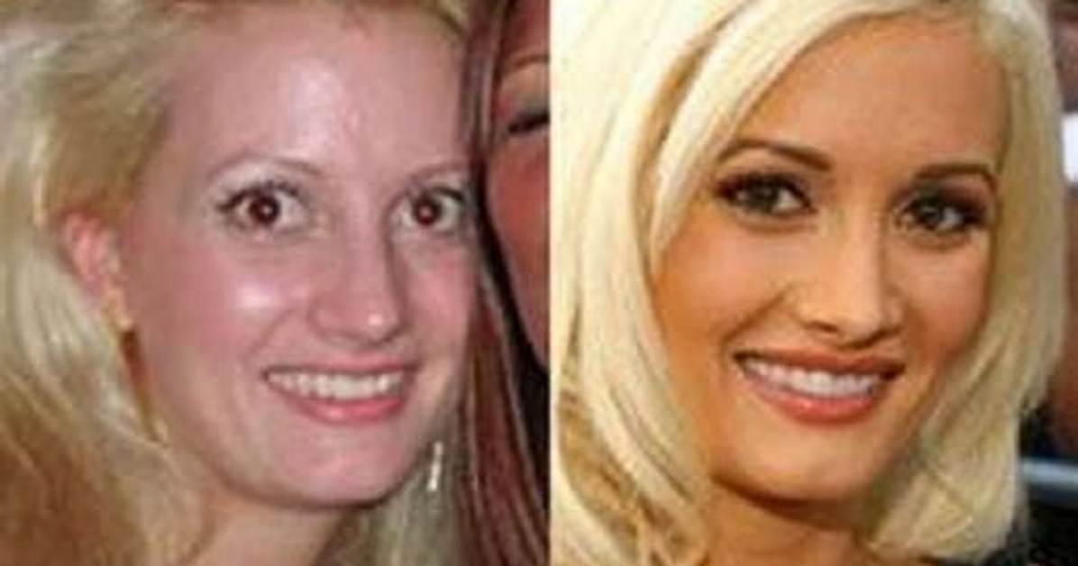 Holly Madison: a Journey Through Transformation - Before and After