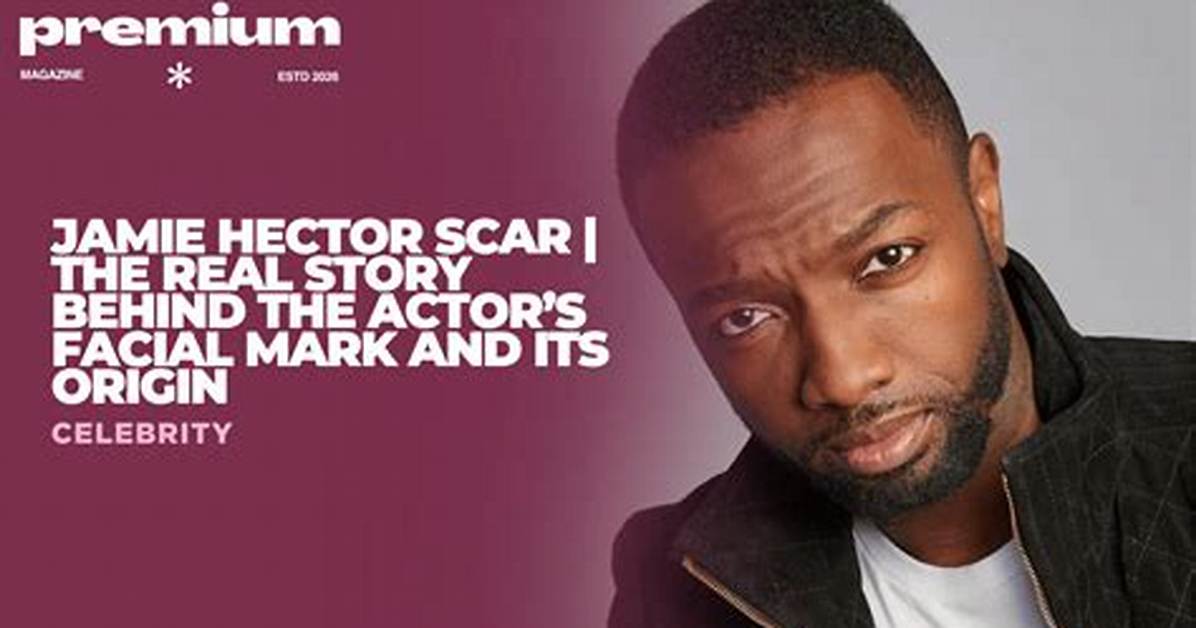 Jamie Hector's Scar: the Story Behind the Iconic Mark