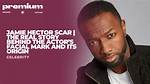 Jamie Hector's Scar: the Story Behind the Iconic Mark