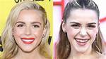Kiernan Shipka Veneers: Teeth Before and After Photos