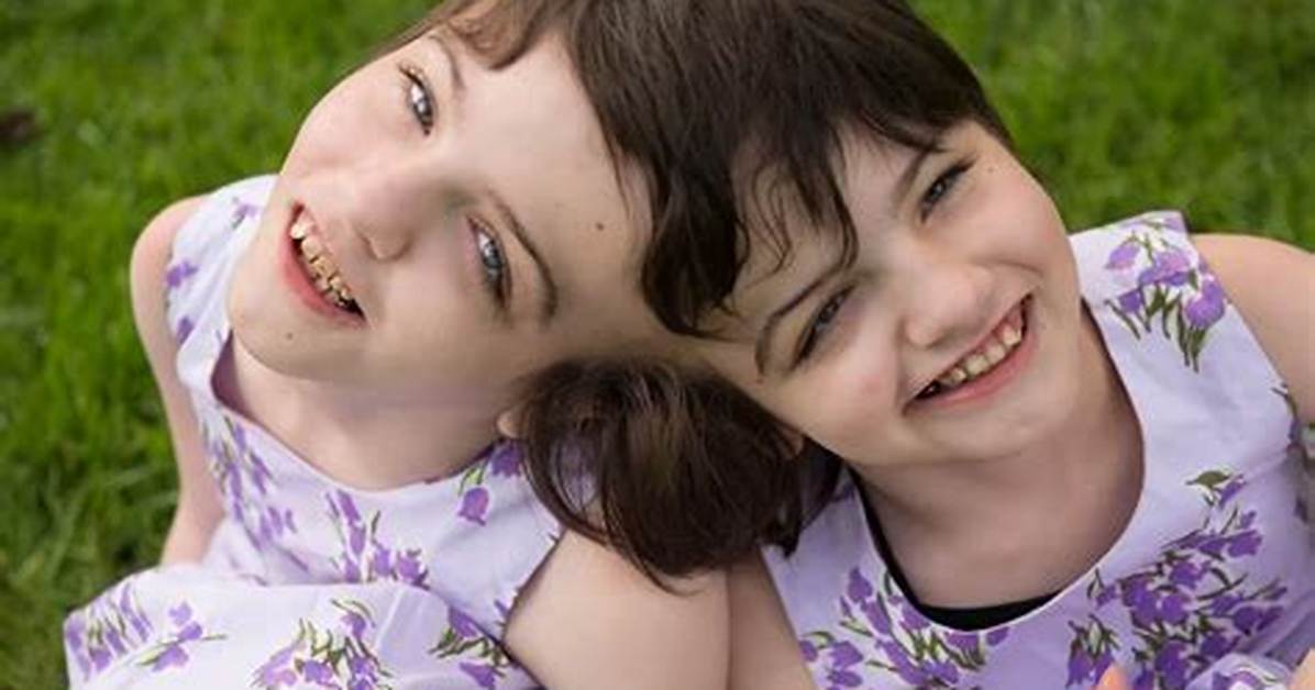 Krista and Tatiana Hogan 2024: the Remarkable Journey of the Twin Sisters