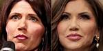 Kristi Noem Plastic Surgery: a Comprehensive Look