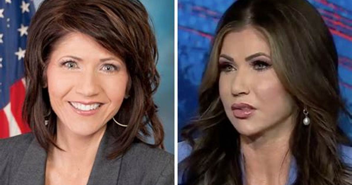 Kristi Noem Plastic Surgery Before After Pictures