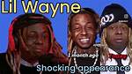 Lil Wayne's Swollen Appearance Explored