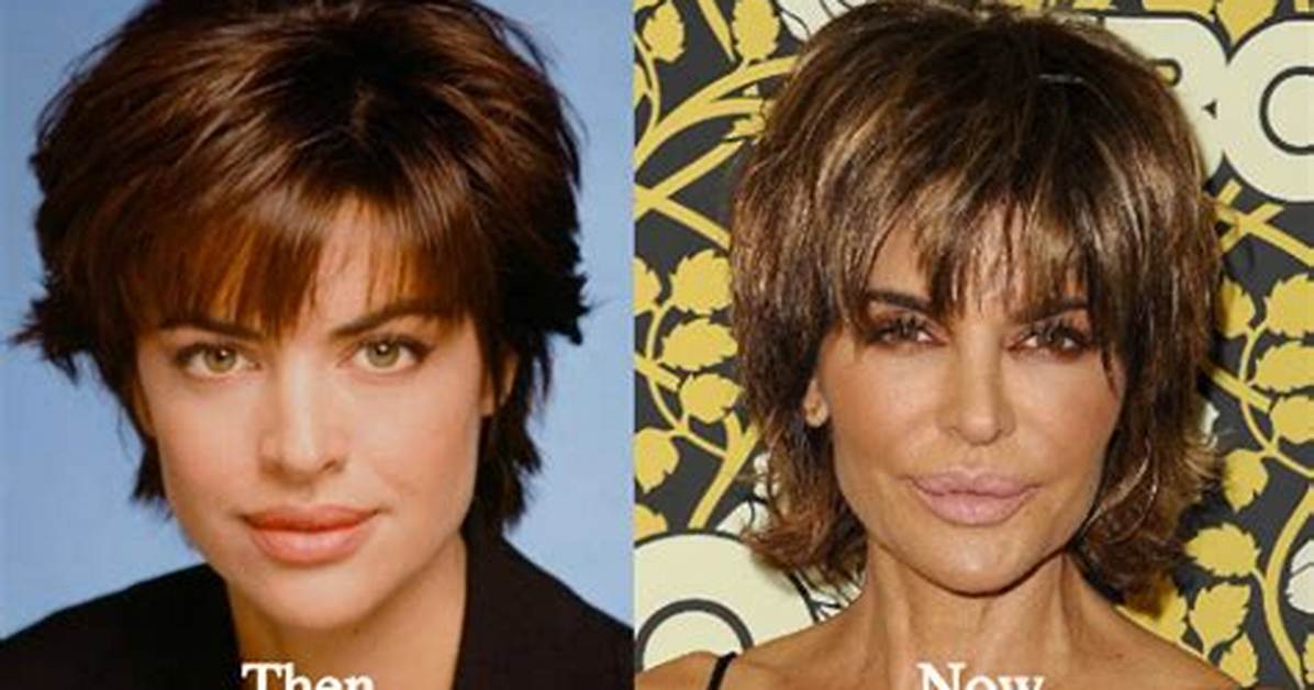 Lisa Rinna Before Surgery: a Deep Dive into Her Transformation