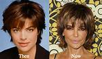 Lisa Rinna Before Surgery: a Deep Dive into Her Transformation