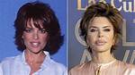 Lisa Rinna's Plastic Surgery Explained |