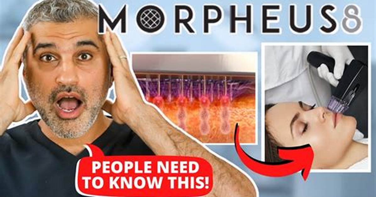 Morpheus8 Ruined My Skin: a Cautionary Tale