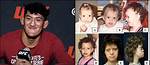 Raul Rosas Jr.'s Unusual Facial Condition: a Medical Mystery