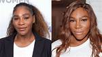 Serena Williams Surgery: a Comprehensive Insight into Her Journey and Recovery