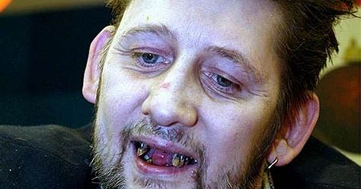 Shane Macgowan Net Worth