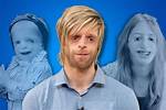 Shining Bright: Actors with Treacher Collins Syndrome