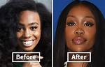 Sza Nose Job: the Truth Behind the Rumors and Transformations