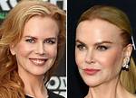 The Intriguing Truth: Nicole Kidman's Plastic Surgery Journey