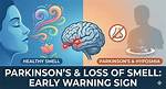 The Smell of Parkinson’s Disease