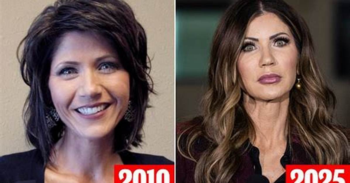 The Transformation of Kristi Noem: Before and After Plastic Surgery Reveal