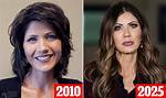 The Transformation of Kristi Noem: Before and After Plastic Surgery Reveal