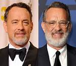 Tom Hanks Nose Job Rumor Unveiled