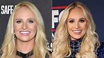 Tomi Lahren's Plastic Surgery Journey