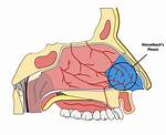 Understanding Kiesselbach Plexus: the Crucial Role in Nasal Health