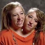 Unraveling the Lives of Abby and Brittany Hensel: Are They Still Alive?