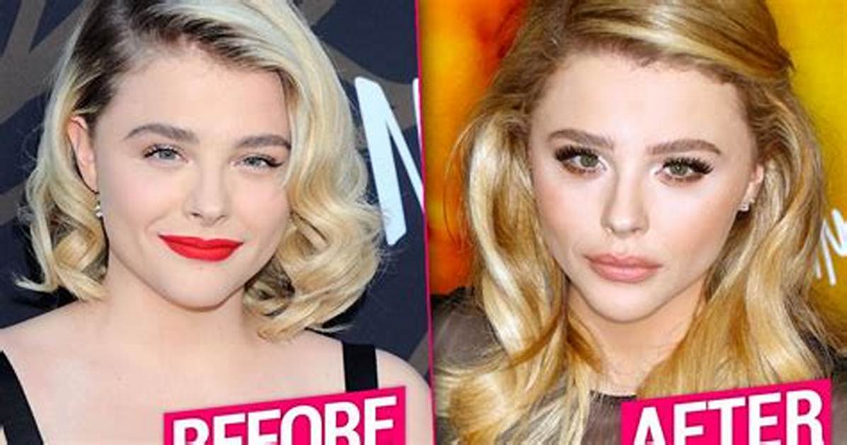 Unveiling Chloe Grace Moretz's Plastic Surgery Secrets: a Comprehensive Exploration