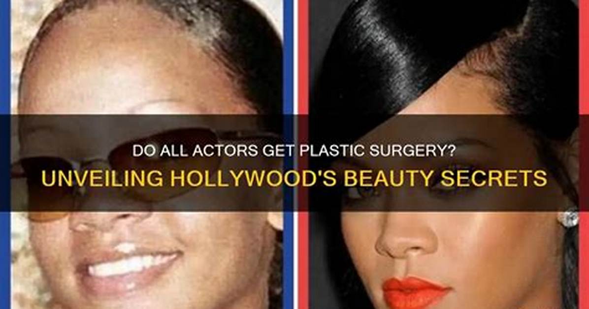 Unveiling the Cosmetic Surgery Secrets of Hollywood Icon Julia Louis-Dreyfus